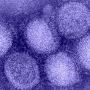 Influenza Virus