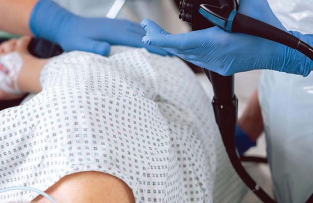 Colonoscopy