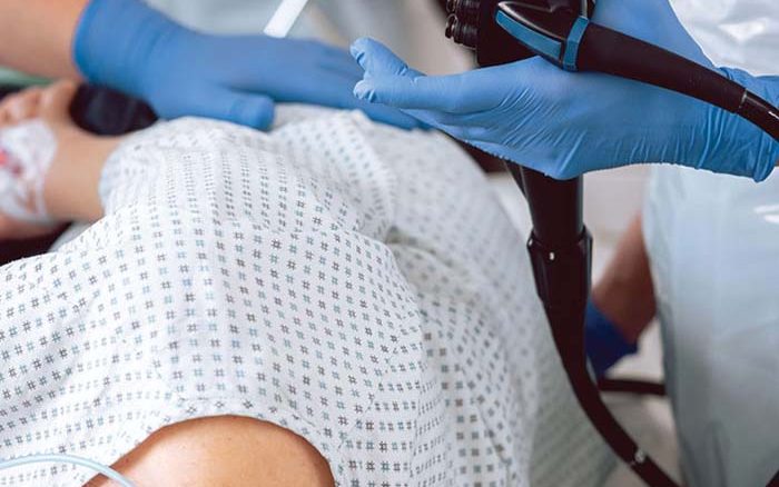 Colonoscopy