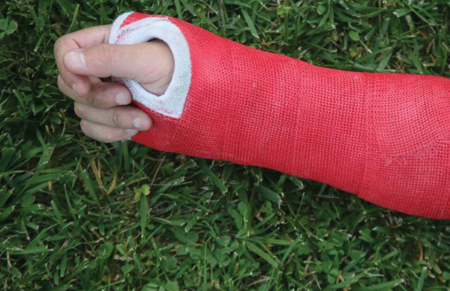 Forearm fracture