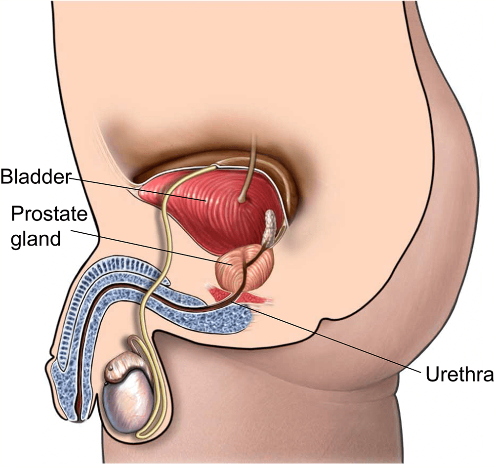 Prostate Surgery