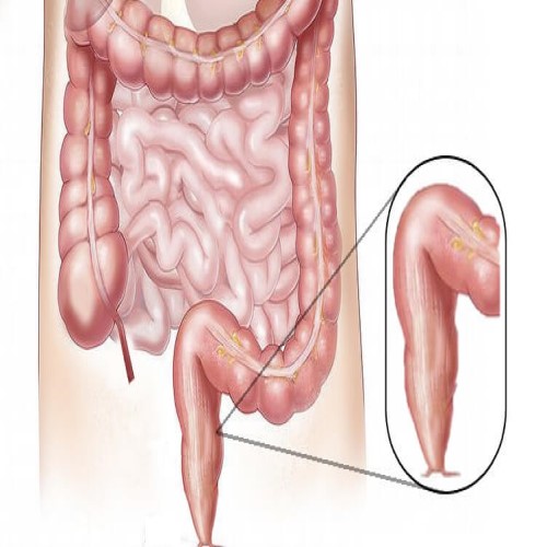 Rectum Surgery